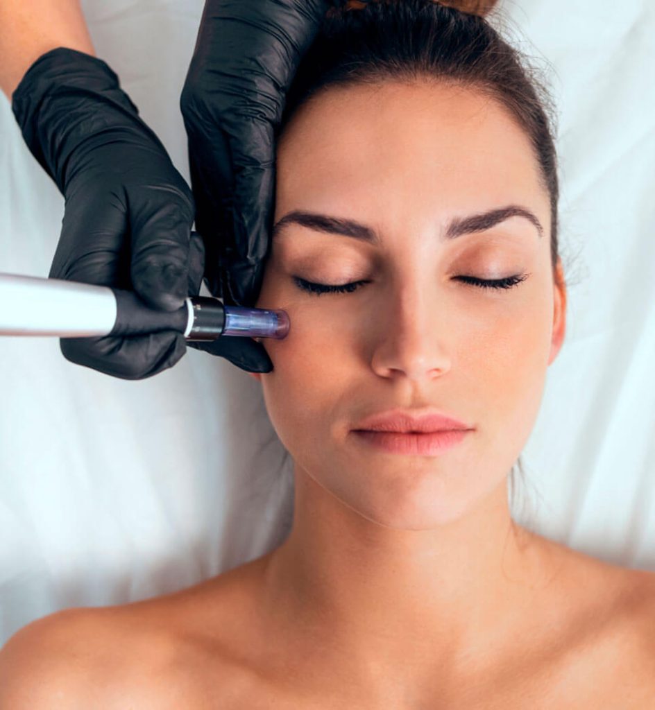 hidratacion-facial-en-malaga-3