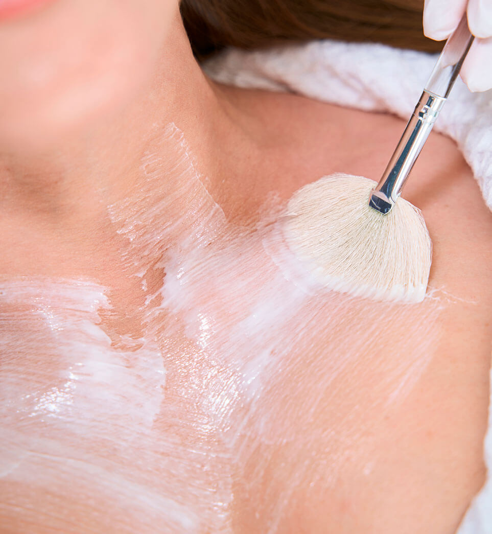 rejuvenecimiento-de-cuello-y-escote-malaga-4