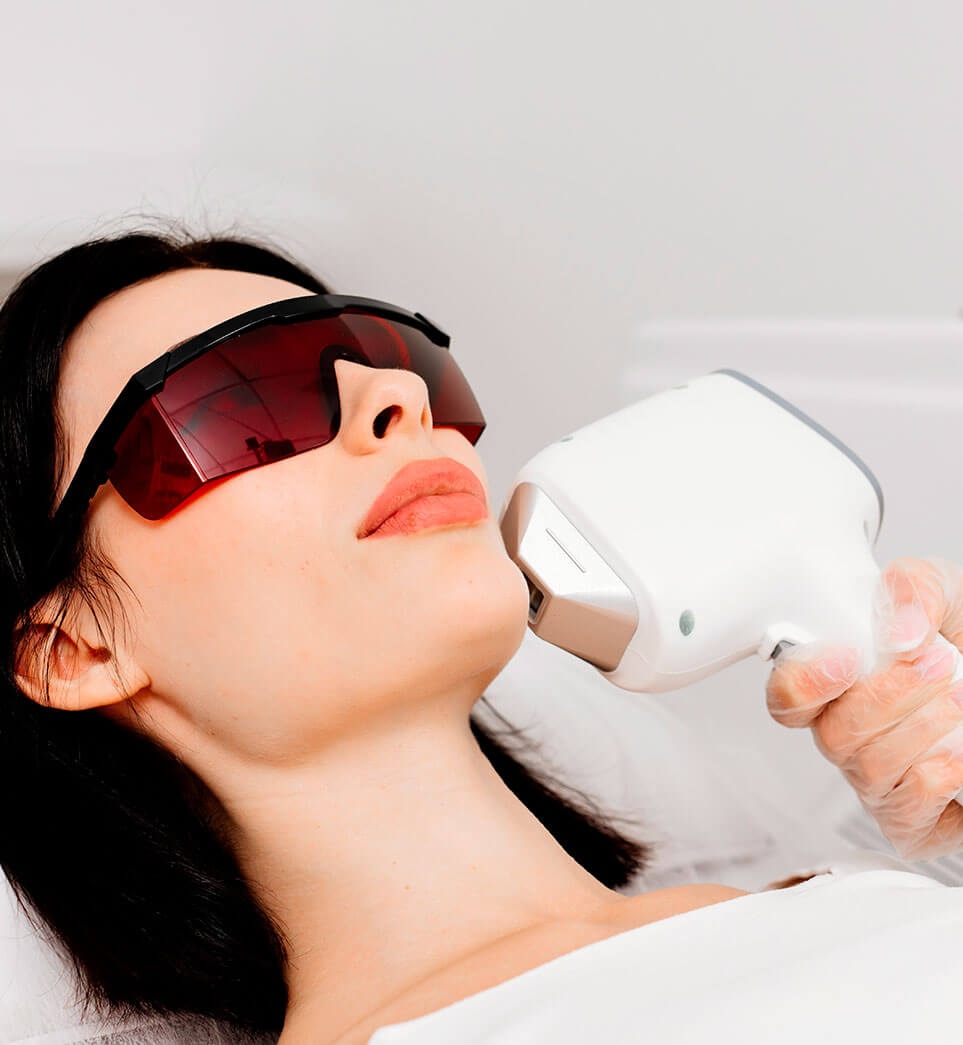 rejuvenecimiento-facial-en-malaga-6