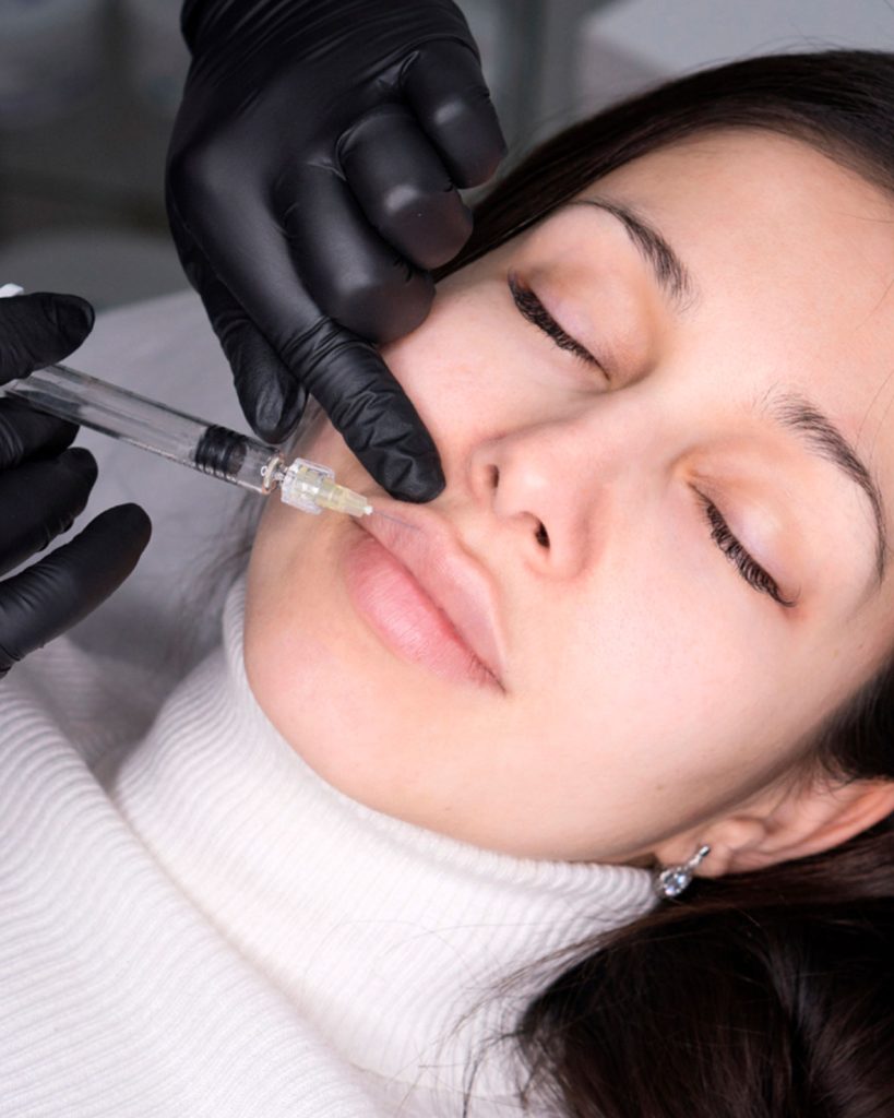 aumento-de-labios-en-malaga