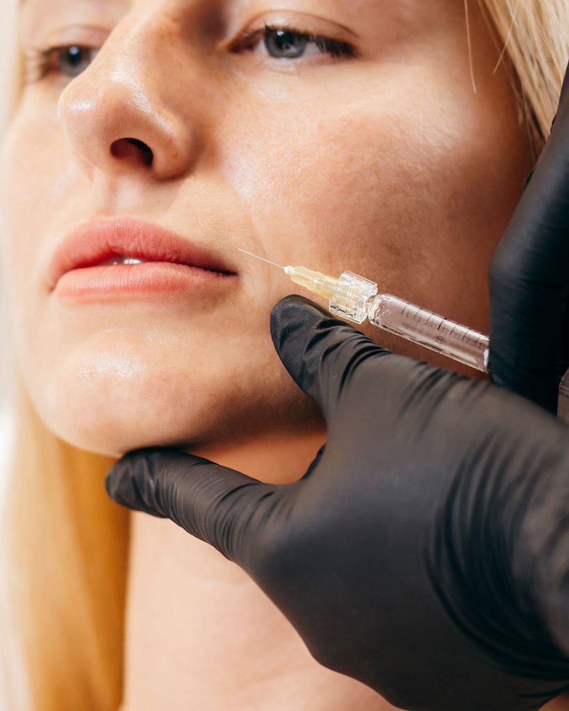 mesoterapia-en-malaga