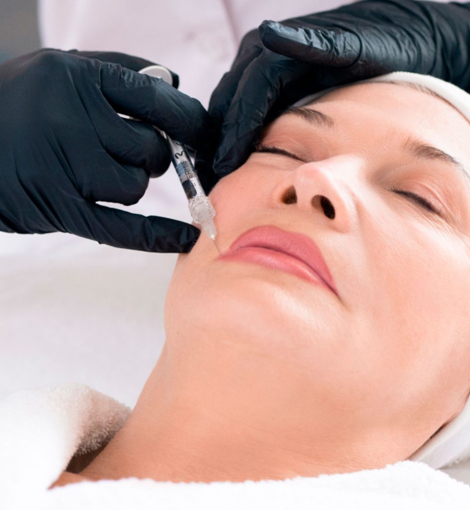 rejuvenecimiento-con-acido-hialuronico-malaga-1