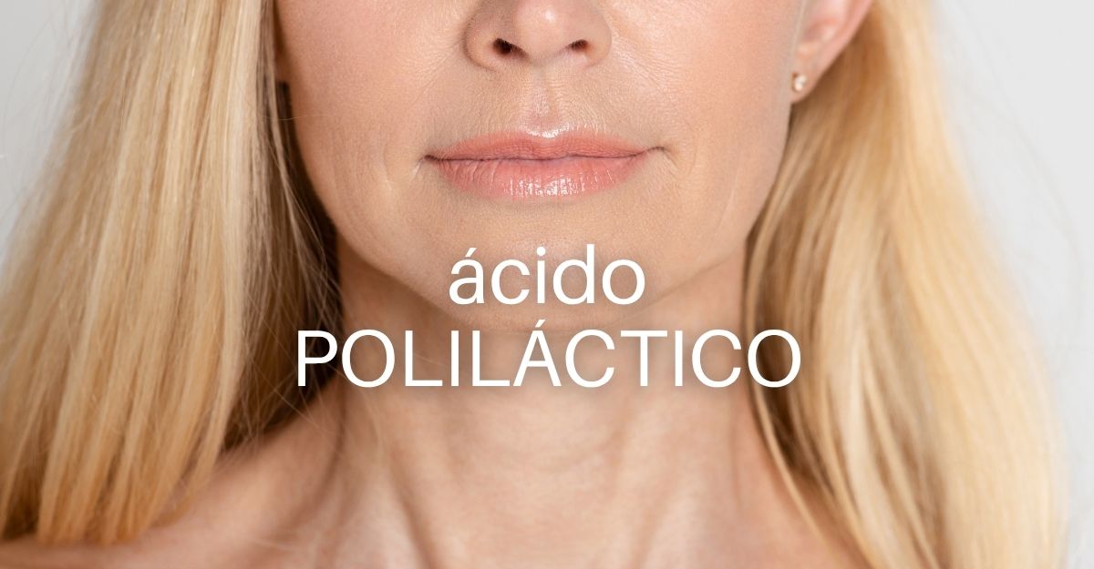 Acido polilactico malaga, resultados acido poliláctico, sculptra, medicina regenerativa, inductores de colageno, clinica estetica málaga, médico estético málaga,m eliminar arrugas málaga