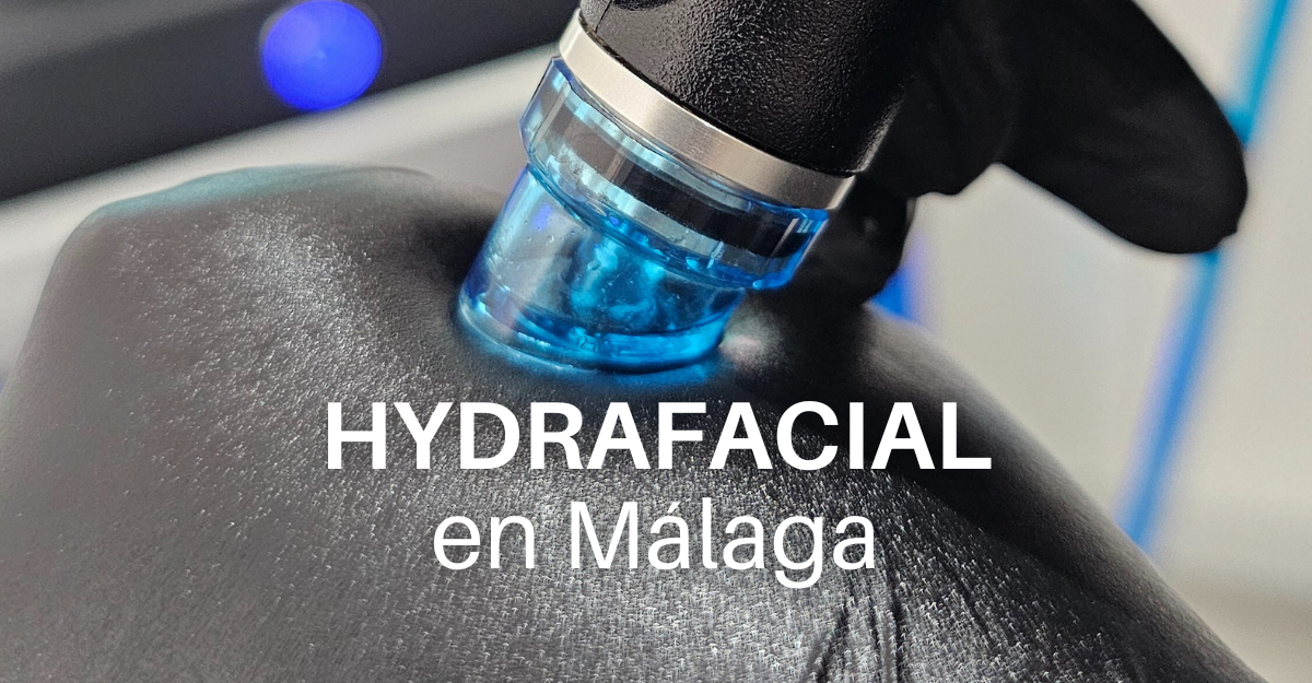 Hydrafacial en málaga el tratamiento facial más demandado, limpieza facial en malaga, limpieza facial profesional en malaga