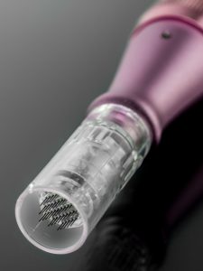 tratamiento de exosomas en málaga, el mejor tratamiento de medicina estética regenerativa, exosomas con dermapen. Multipunción con exosomas, promoción peeling + exosomas