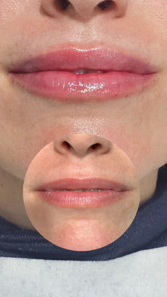 los mejores tratamientos faciales en málaga, clinica estetica en el limonar en málaga, tratamientos para novias, tratamientos de belleza en málaga